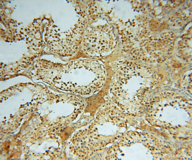 HDAC2 Antibody in Immunohistochemistry (Paraffin) (IHC (P))