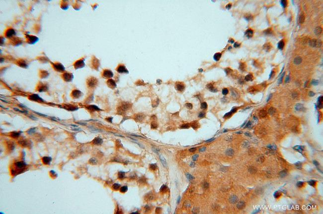 HDAC2 Antibody in Immunohistochemistry (Paraffin) (IHC (P))