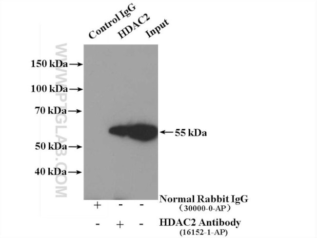 HDAC2 Antibody in Immunoprecipitation (IP)