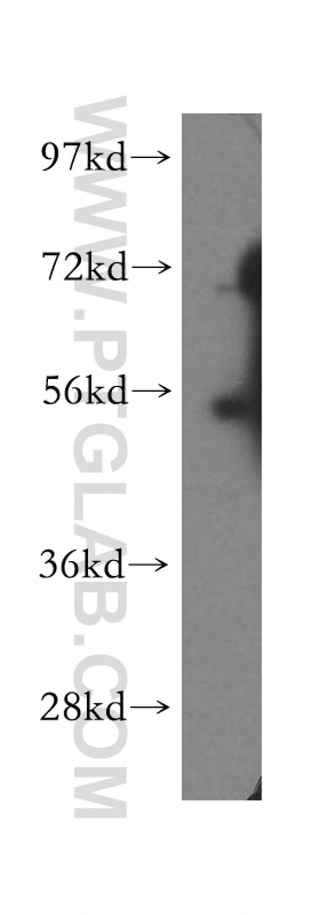 HDAC2 Antibody in Western Blot (WB)