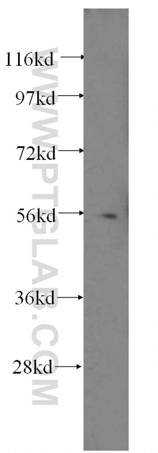 HDAC2 Antibody in Western Blot (WB)