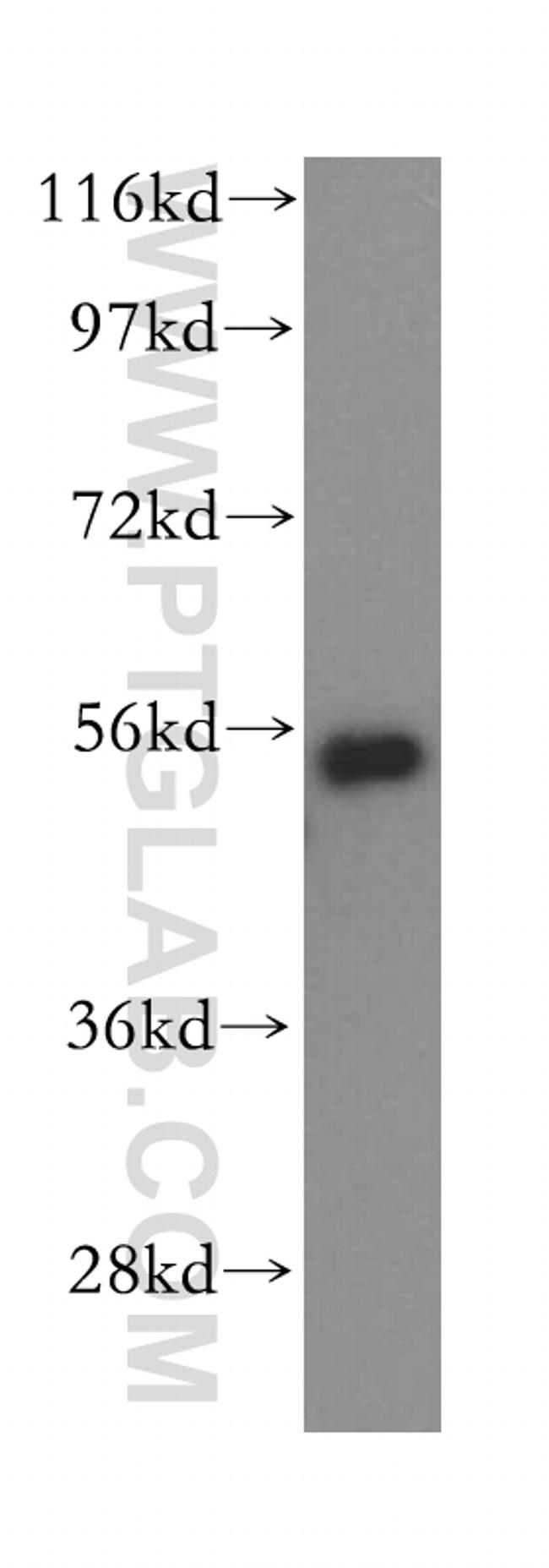 HDAC2 Antibody in Western Blot (WB)