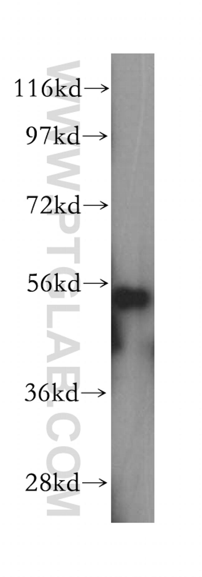 HDAC2 Antibody in Western Blot (WB)