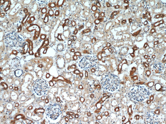 CCR2a Antibody in Immunohistochemistry (Paraffin) (IHC (P))