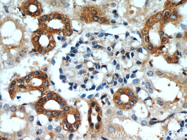 CCR2a Antibody in Immunohistochemistry (Paraffin) (IHC (P))