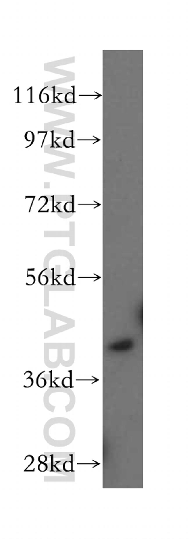 CCR2a Antibody in Western Blot (WB)