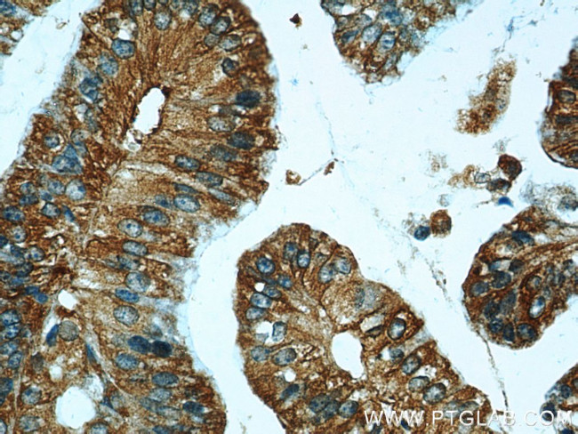 CCR2a Antibody in Immunohistochemistry (Paraffin) (IHC (P))