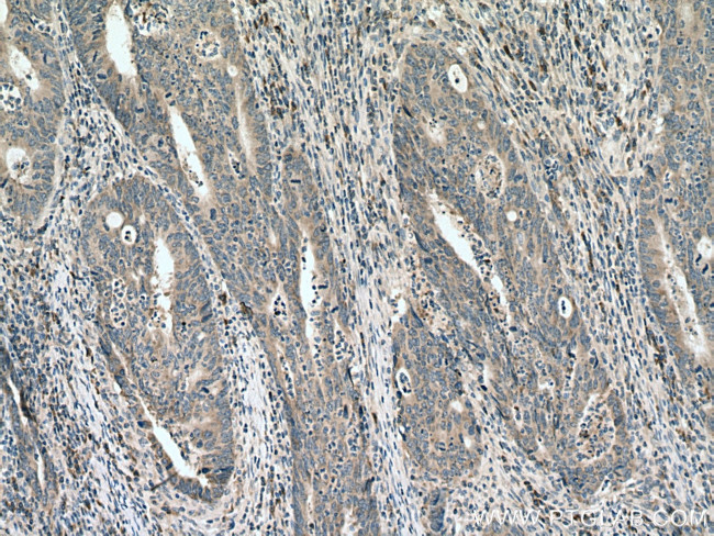 KRAS-2B Antibody in Immunohistochemistry (Paraffin) (IHC (P))