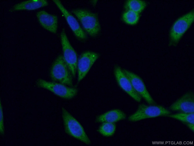 KRAS-2B Antibody in Immunocytochemistry (ICC/IF)