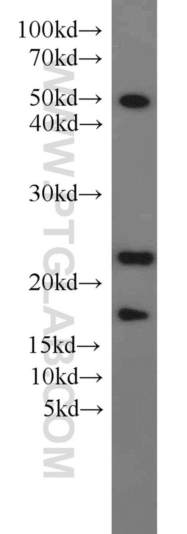 KRAS-2B Antibody in Western Blot (WB)