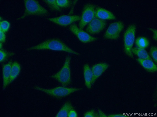 KRAS-2B Antibody in Immunocytochemistry (ICC/IF)