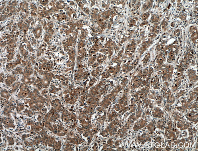 KRAS-2B Antibody in Immunohistochemistry (Paraffin) (IHC (P))