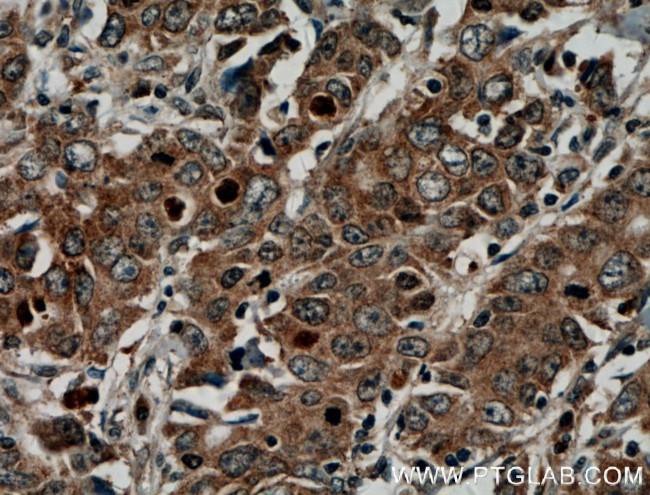 KRAS-2B Antibody in Immunohistochemistry (Paraffin) (IHC (P))