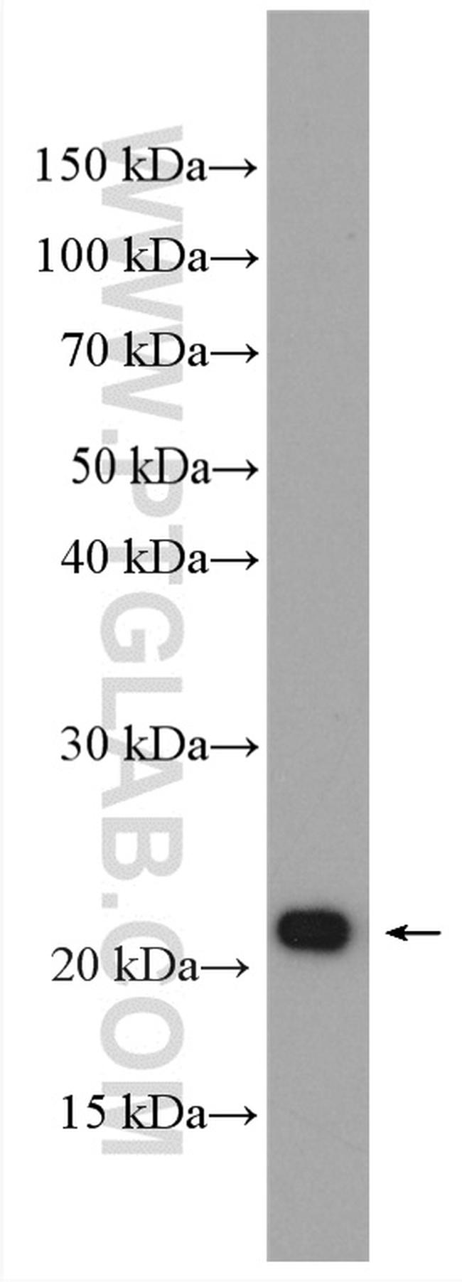 KRAS-2B Antibody in Western Blot (WB)