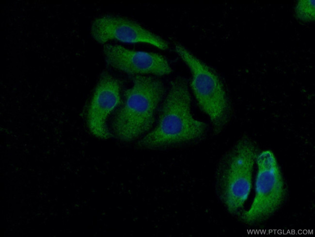 KRAS-2A Antibody in Immunocytochemistry (ICC/IF)