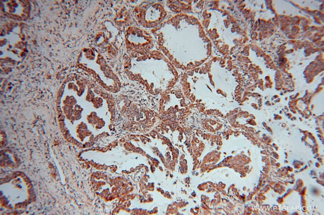 KRAS-2A Antibody in Immunohistochemistry (Paraffin) (IHC (P))