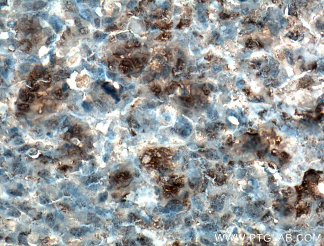 Osteocalcin Antibody in Immunohistochemistry (Paraffin) (IHC (P))