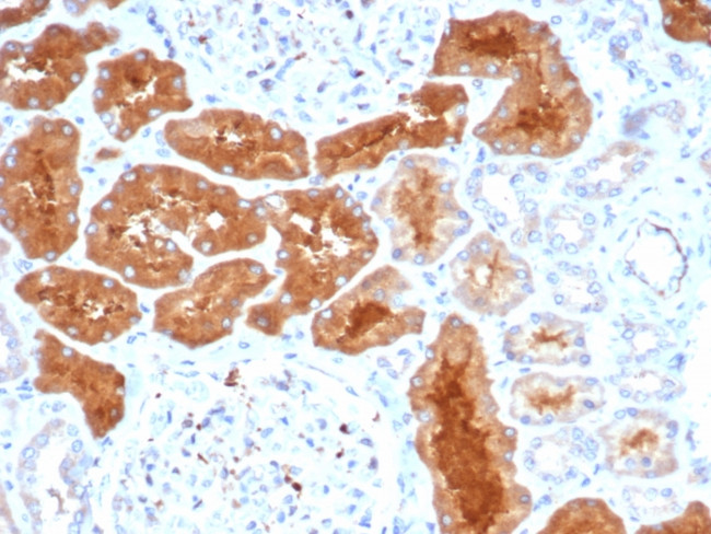 DAXX Antibody in Immunohistochemistry (Paraffin) (IHC (P))