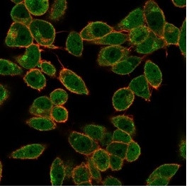 DAXX (Transcriptional Corepressor) Antibody in Immunocytochemistry (ICC/IF)