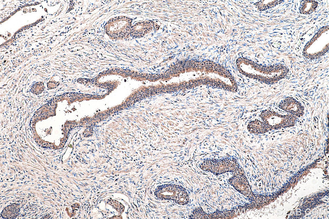 Presenilin-1 Antibody in Immunohistochemistry (Paraffin) (IHC (P))