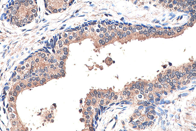 Presenilin-1 Antibody in Immunohistochemistry (Paraffin) (IHC (P))