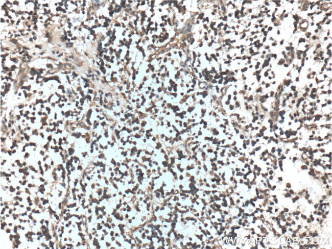 Presenilin-1 Antibody in Immunohistochemistry (Paraffin) (IHC (P))