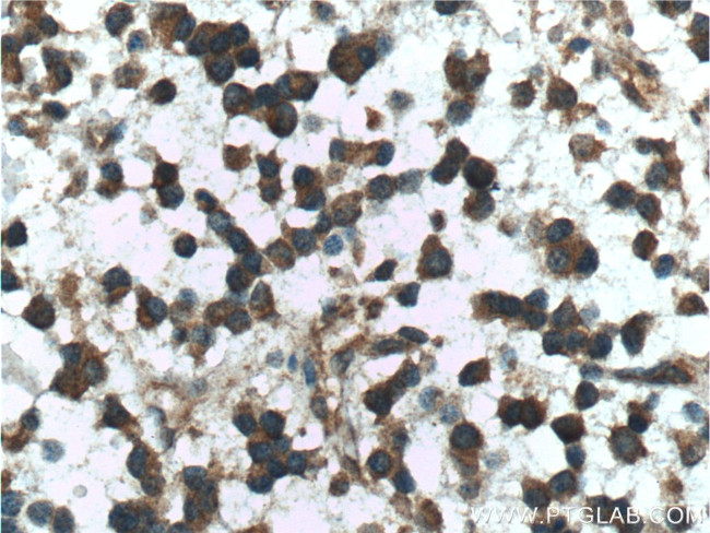 Presenilin-1 Antibody in Immunohistochemistry (Paraffin) (IHC (P))