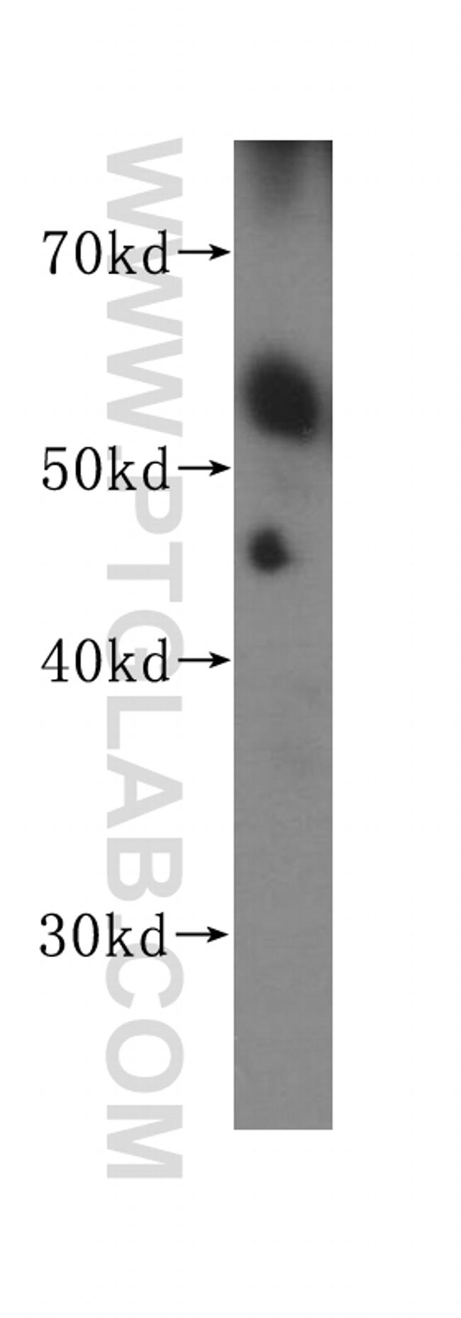 Presenilin-1 Antibody in Western Blot (WB)