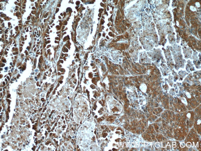 HDAC4 Antibody in Immunohistochemistry (Paraffin) (IHC (P))