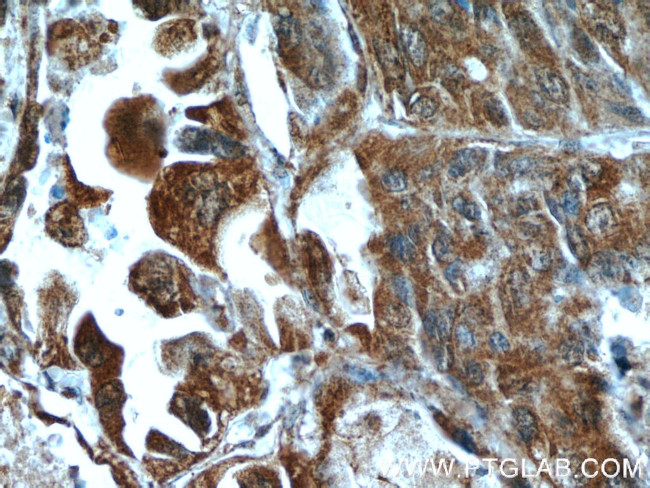 HDAC4 Antibody in Immunohistochemistry (Paraffin) (IHC (P))