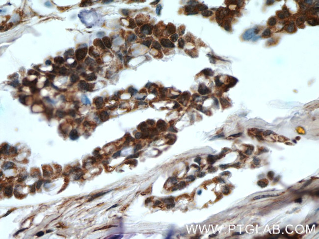 HDAC4 Antibody in Immunohistochemistry (Paraffin) (IHC (P))