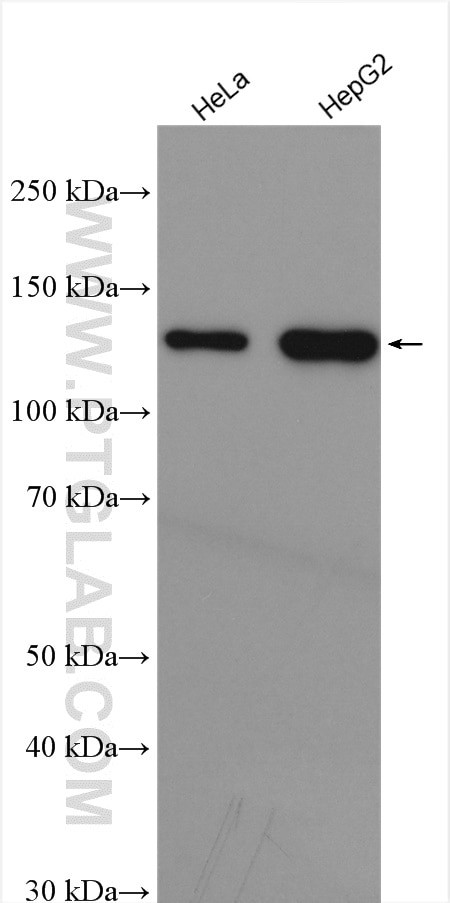 HDAC4 Antibody in Western Blot (WB)