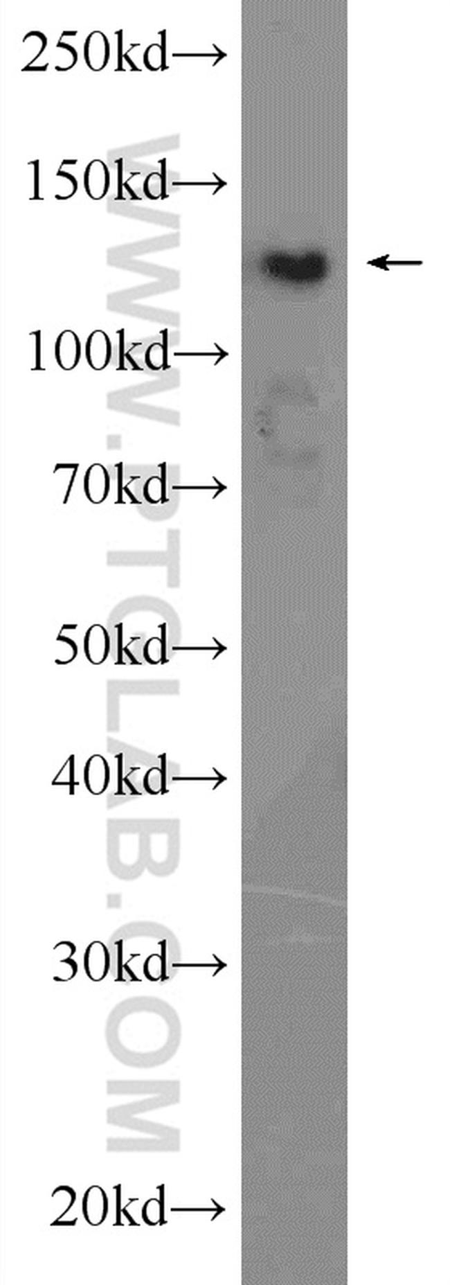 HDAC4 Antibody in Western Blot (WB)