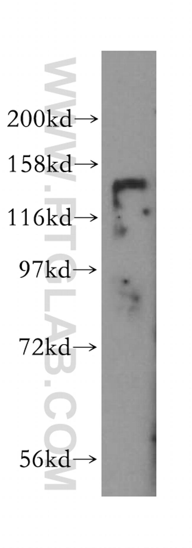 HDAC4 Antibody in Western Blot (WB)