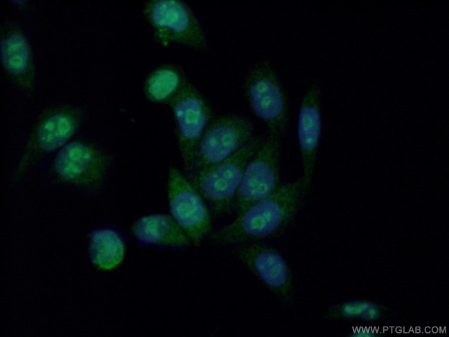 HDAC5 Antibody in Immunocytochemistry (ICC/IF)