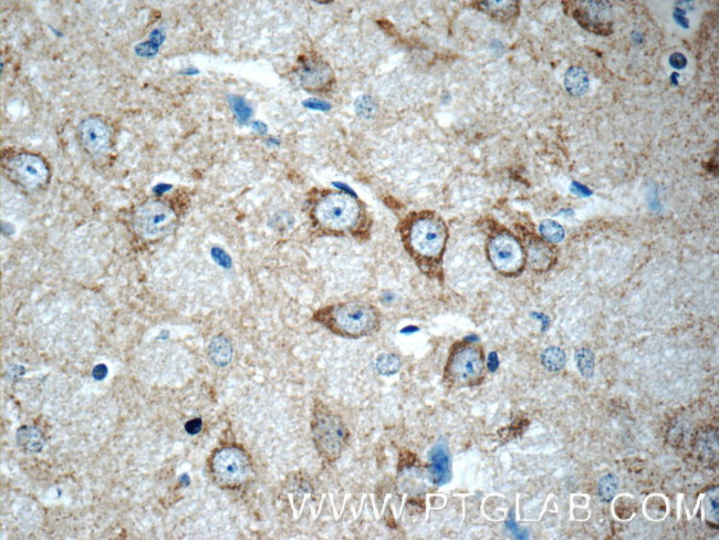 HDAC5 Antibody in Immunohistochemistry (Paraffin) (IHC (P))