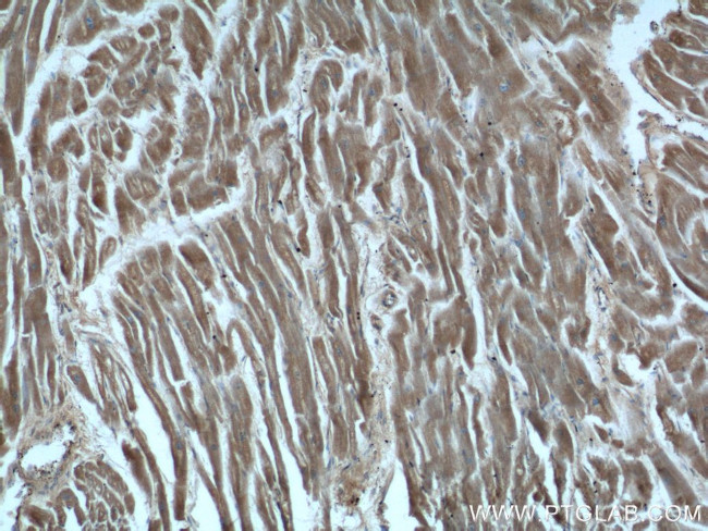 HDAC5 Antibody in Immunohistochemistry (Paraffin) (IHC (P))