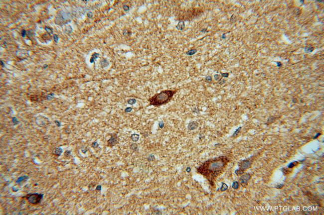 HDAC5 Antibody in Immunohistochemistry (Paraffin) (IHC (P))