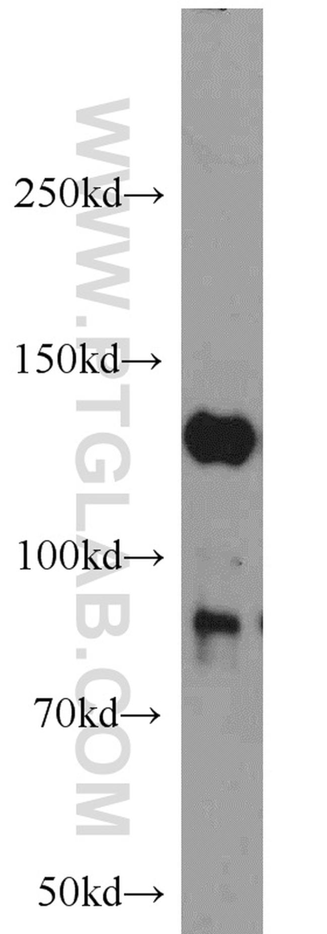 HDAC5 Antibody in Western Blot (WB)