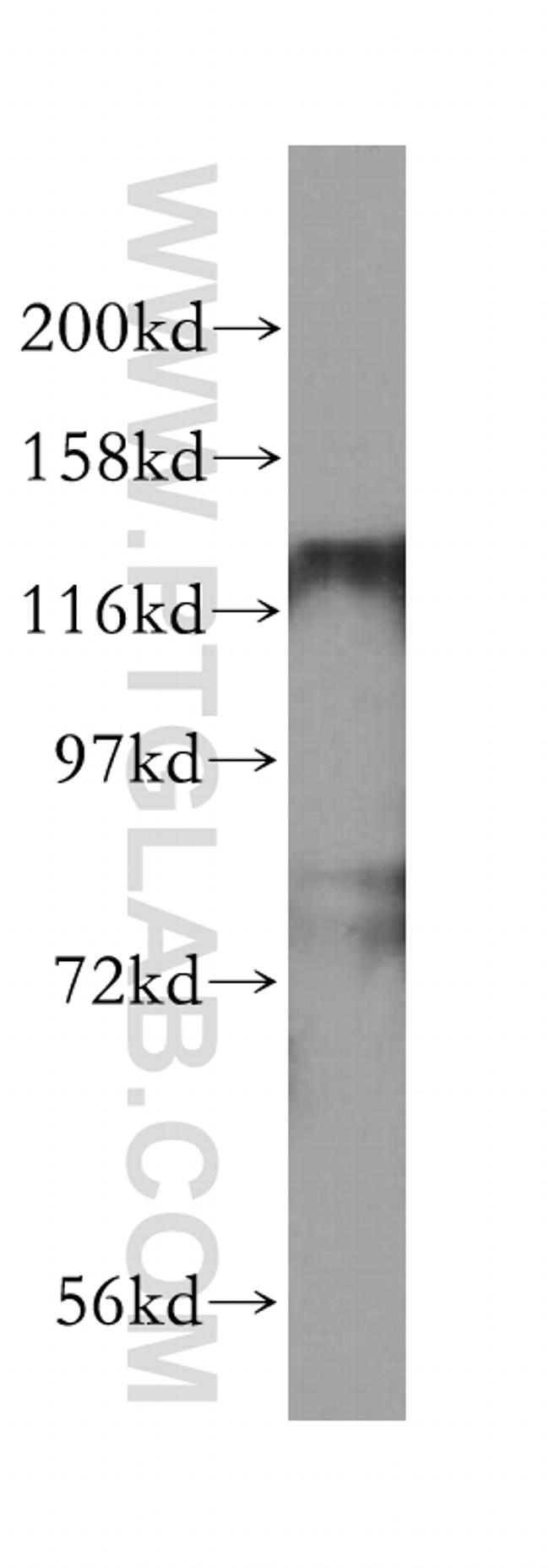 HDAC5 Antibody in Western Blot (WB)