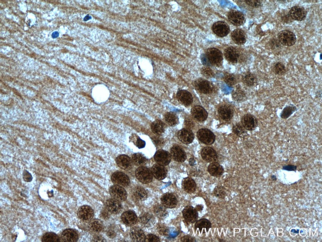 HDAC6 Antibody in Immunohistochemistry (Paraffin) (IHC (P))