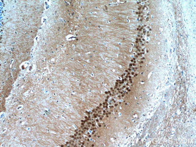 HDAC6 Antibody in Immunohistochemistry (Paraffin) (IHC (P))