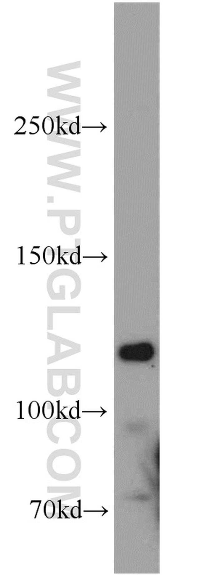 HDAC6 Antibody in Western Blot (WB)