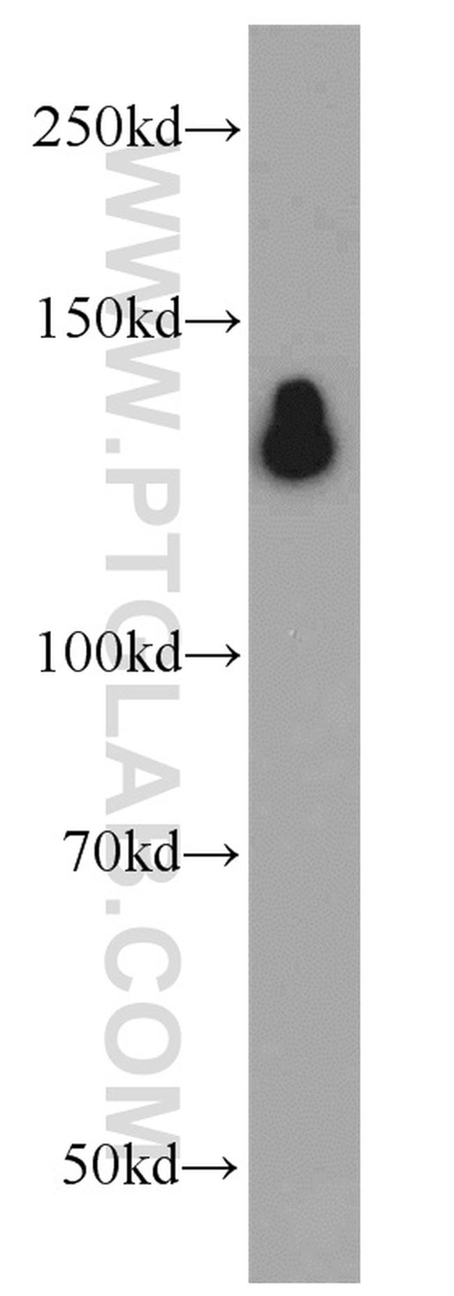 HDAC6 Antibody in Western Blot (WB)