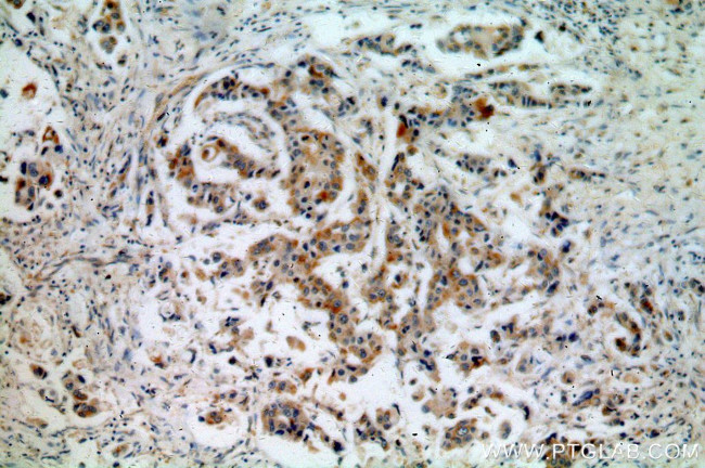 PSEN2 Antibody in Immunohistochemistry (Paraffin) (IHC (P))