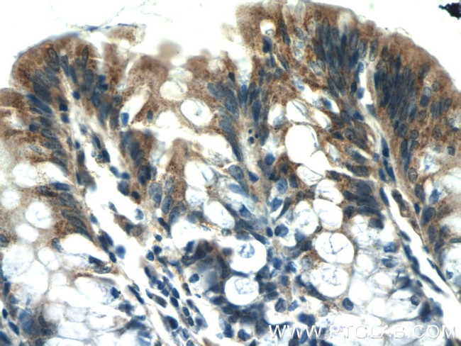 PSEN2 Antibody in Immunohistochemistry (Paraffin) (IHC (P))