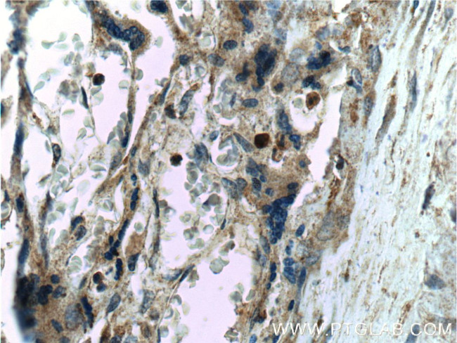 PSEN2 Antibody in Immunohistochemistry (Paraffin) (IHC (P))