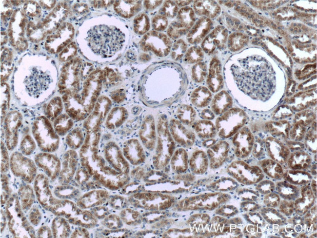 PSEN2 Antibody in Immunohistochemistry (Paraffin) (IHC (P))