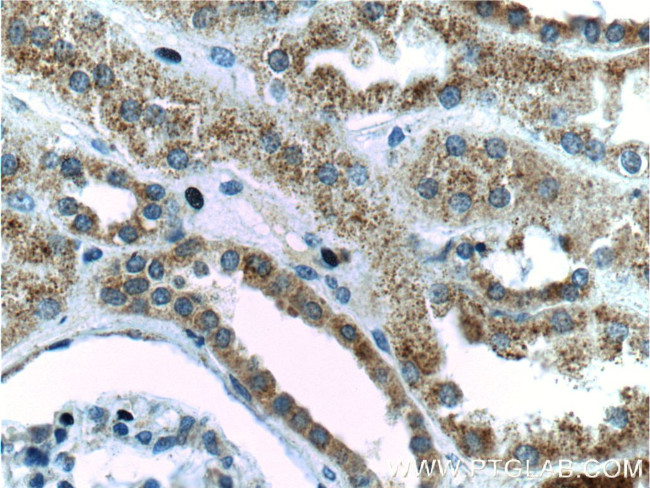 PSEN2 Antibody in Immunohistochemistry (Paraffin) (IHC (P))