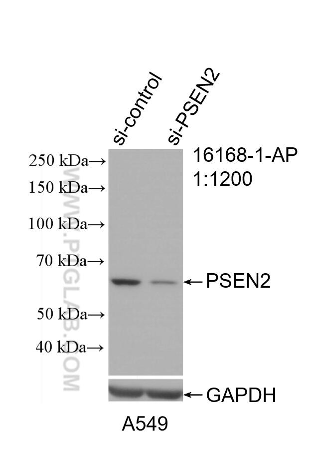 PSEN2 Antibody in Western Blot (WB)